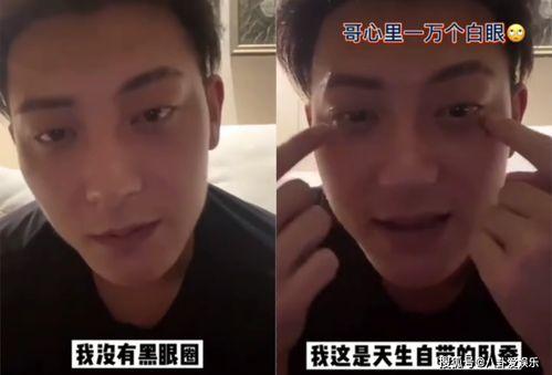 吃瓜黑眼圈,揭秘吃瓜黑眼圈的成因与缓解方法