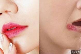 吃瓜嘴角开裂,揭秘过度吃瓜的危害